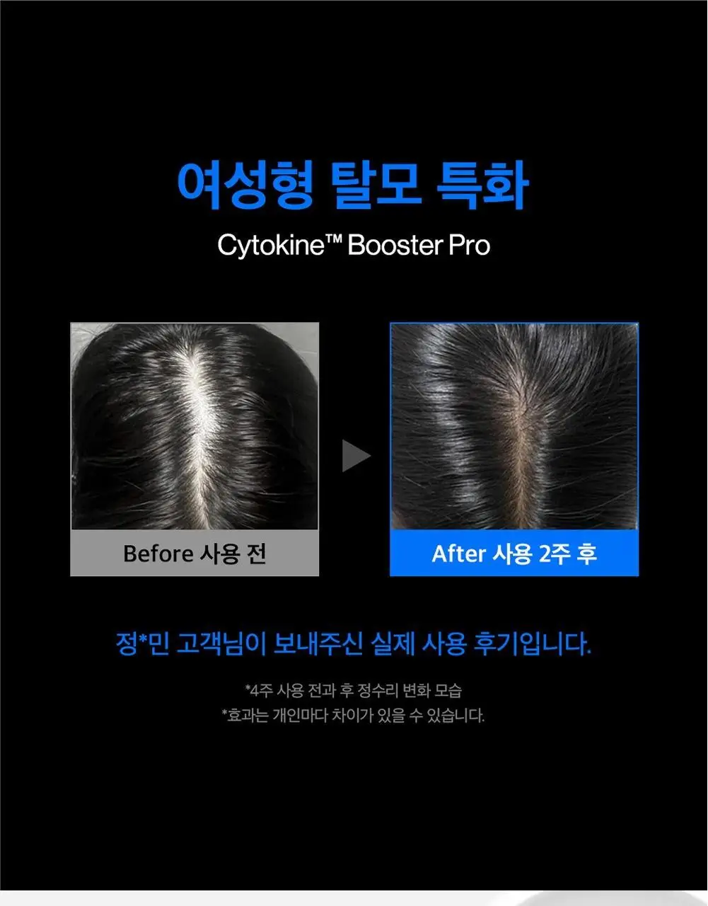 [탈모증상개선] 리필드 사이토카인 부스터 프로 70ml 단품/기획 2종 택1 상세페이지 14